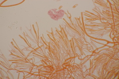 Calocera viscosa