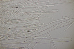 Lachnellula occidentalis
