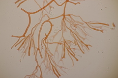 Calocera viscosa
