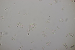 Calocera viscosa