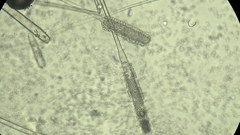 Mycotypha