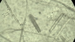 Mycotypha