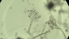 Radiomyces