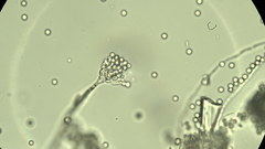 Radiomyces