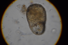 Centropyxis elongata