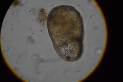 Centropyxis elongata