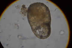 Centropyxis elongata