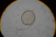 Microchlamys patella