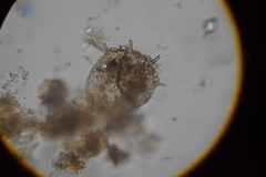 Centropyxis aculeata