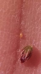 Juncus brachycephalus