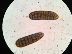 Berkleasmium concinnum