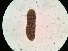 Berkleasmium concinnum