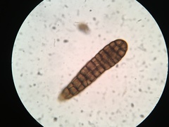 Berkleasmium concinnum