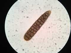 Berkleasmium concinnum