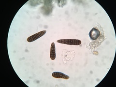 Berkleasmium concinnum