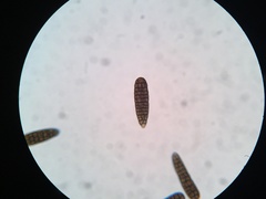 Berkleasmium concinnum