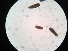 Berkleasmium concinnum