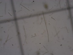 Dolichospermum planctonicum