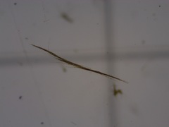 Aphanizomenon flosaquae