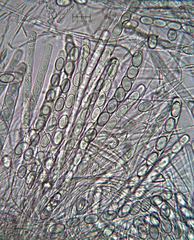 Trichophaeopsis bicuspis