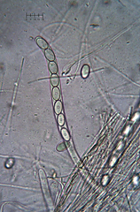 Trichophaeopsis bicuspis