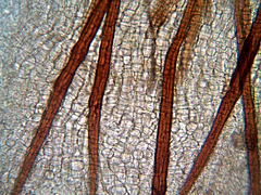 Trichophaeopsis bicuspis