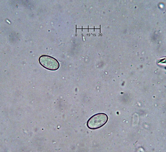 Trichophaeopsis bicuspis