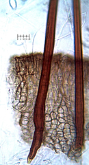 Trichophaeopsis bicuspis