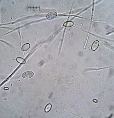 Trichophaeopsis bicuspis