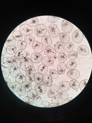 Noctiluca scintillans