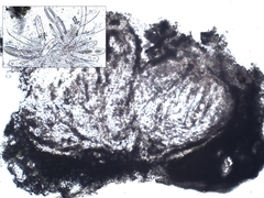 Pertusaria heterochroa