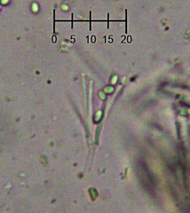 Trichoderma flavipes