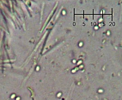 Trichoderma flavipes