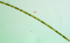 Hyalotheca