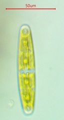 Closterium navicula