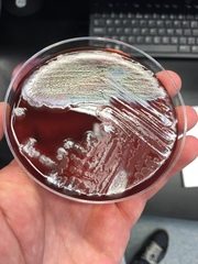 Pseudomonas