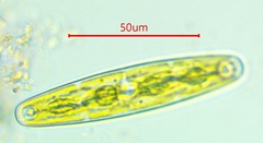 Closterium navicula