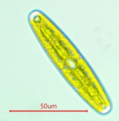 Closterium navicula