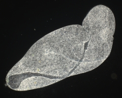 Spirostomum