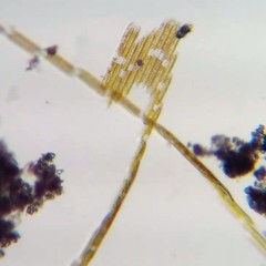 Bacillaria paxillifera