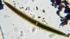 Closterium acerosum