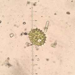 Pseudopediastrum boryanum