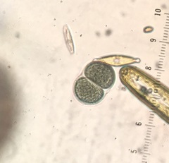 Chroococcus turgidus