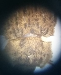 Leichenum
