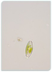 Sellaphora pupula