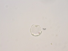 Stephanodiscus niagarae