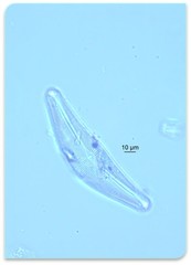 Cymbella