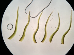 Dicranella cerviculata