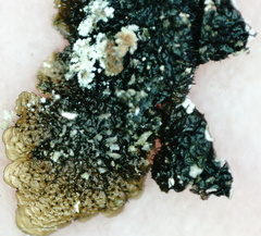 Melanelixia glabratula