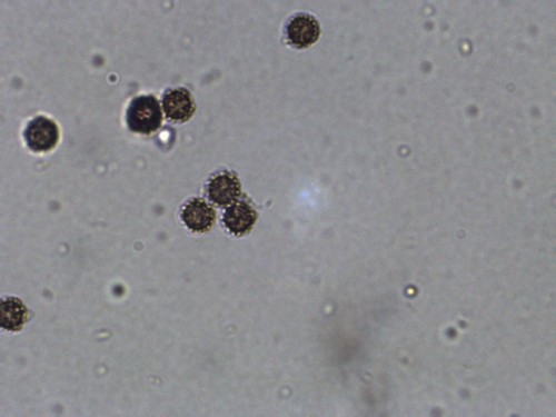 Trichaster (Photo 2 of 3)